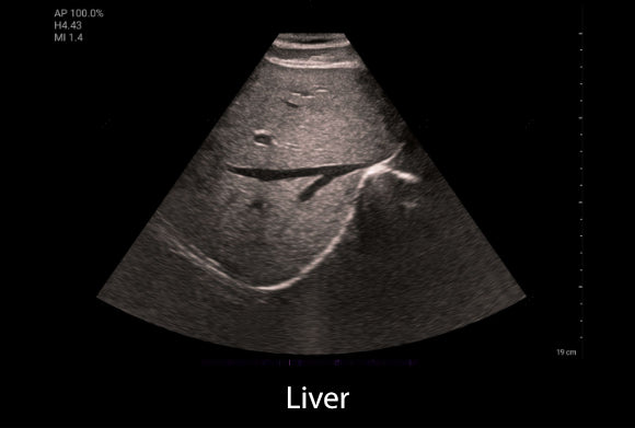 Clinical image - Liver