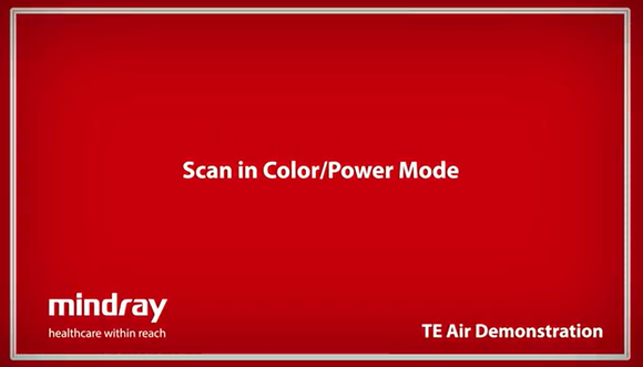 Mindray TE Air Tutorial - Scan in Color/Power Mode
