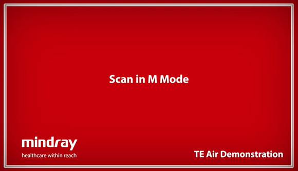 Mindray TE Air Tutorial - Scan in B Mode