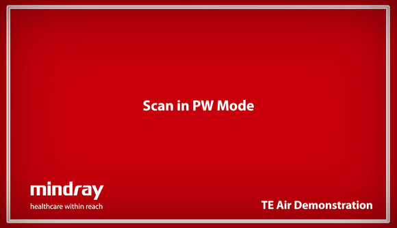 Mindray TE Air Tutorial - Scan in Pulse Wave (PW) Mode