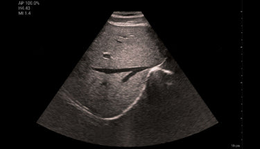 Clinical image/video cover - Liver