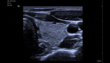 Clinical image/video cover - Thyroid