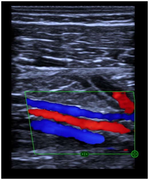 e5M Color Mode Clinical Image