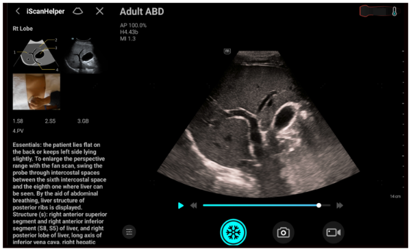 e5M iScanHelper Function Clinical Image