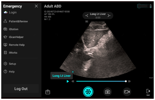 e5M iWorks Function Clinical Image