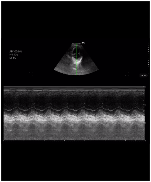 e5M M Mode Clinical Image