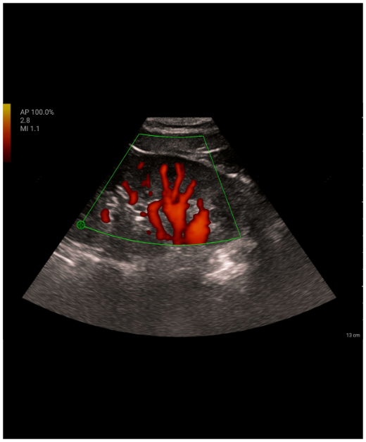 e5M Power Mode Clinical Image