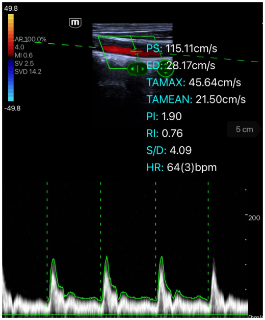 e5M PW Mode Clinical Image