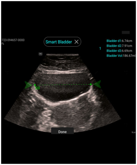 e5M Smart Bladder Function Clinical Image