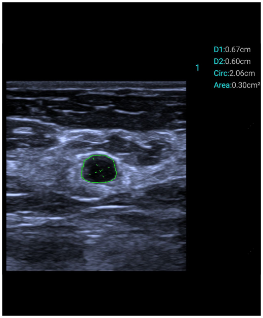 e5M Smart Calc Function Clinical Image